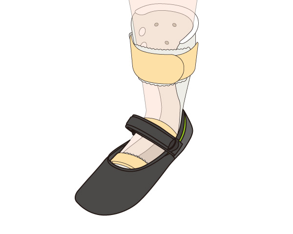 Gaitfix（ゲイトフィックス）使用例　シューホン等を装着時
