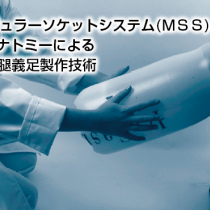 Ossur新世代の下腿義足製作技術