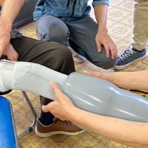 「誰が作ったとしても、適合のいい義足を提供したい」 技術の均一化と継承のキーとなるダイレクトソケット